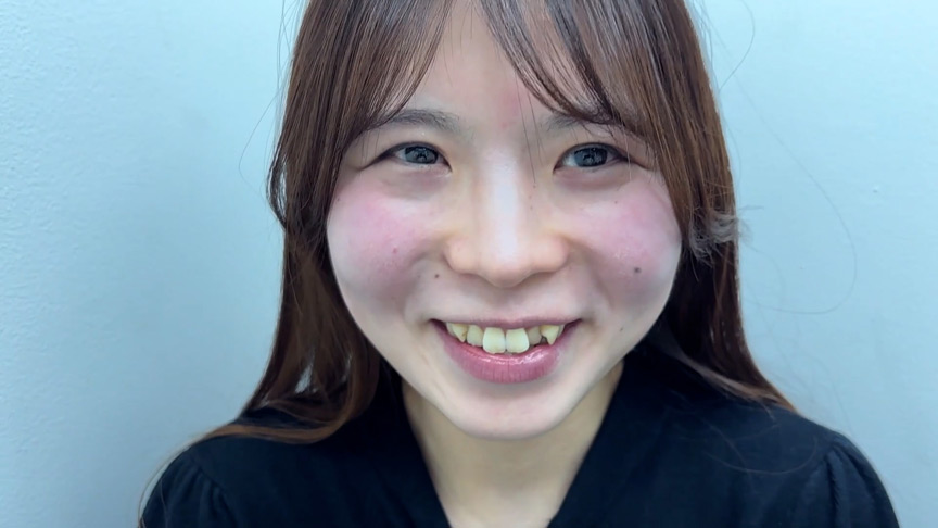 「【素人ナンパ】製造業事務ゆうかちゃんの街角くすぐり体験！恥じらう反応がたまらない」のサムネイル