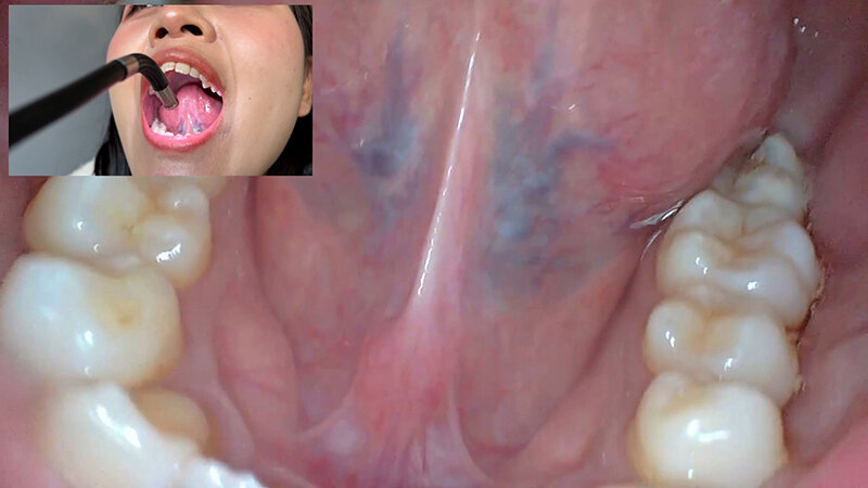 「【素人ナンパ】コールセンター勤務の美人お姉さんに街角で声かけ!口内観察に恥じらう姿が可愛すぎる」のサンプル画像15枚目