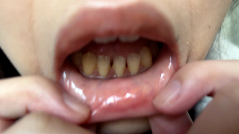 「【素人ナンパ】コールセンター勤務の美人お姉さんに街角で声かけ!口内観察に恥じらう姿が可愛すぎる」のサンプル画像5枚目