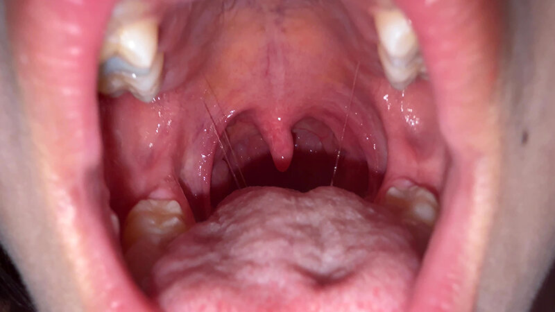 「【七藤優亜】超長舌お姉さんの開口器観察プレイ｜素人個人撮影で魅せる濃厚舌技」のサンプル画像6枚目