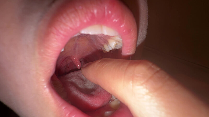 「【七藤優亜】超長舌お姉さんの開口器観察プレイ｜素人個人撮影で魅せる濃厚舌技」のサンプル画像8枚目