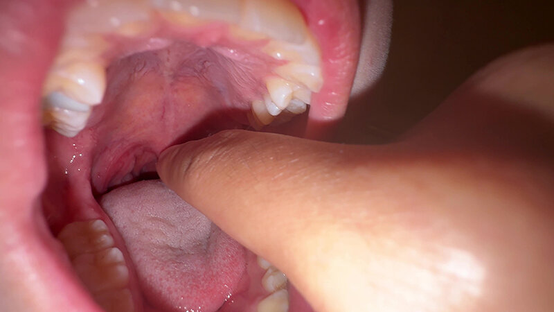 「【七藤優亜】超長舌お姉さんの開口器観察プレイ｜素人個人撮影で魅せる濃厚舌技」のサンプル画像9枚目