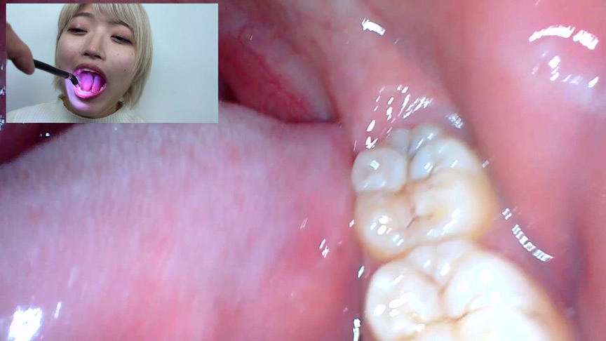 「【口腔観察】歯・舌・喉をじっくり接写!素人4名の口内フェチ動画55分セット」のサンプル画像10枚目