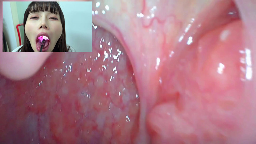 「【口腔観察】歯・舌・喉をじっくり接写!素人4名の口内フェチ動画55分セット」のサンプル画像3枚目