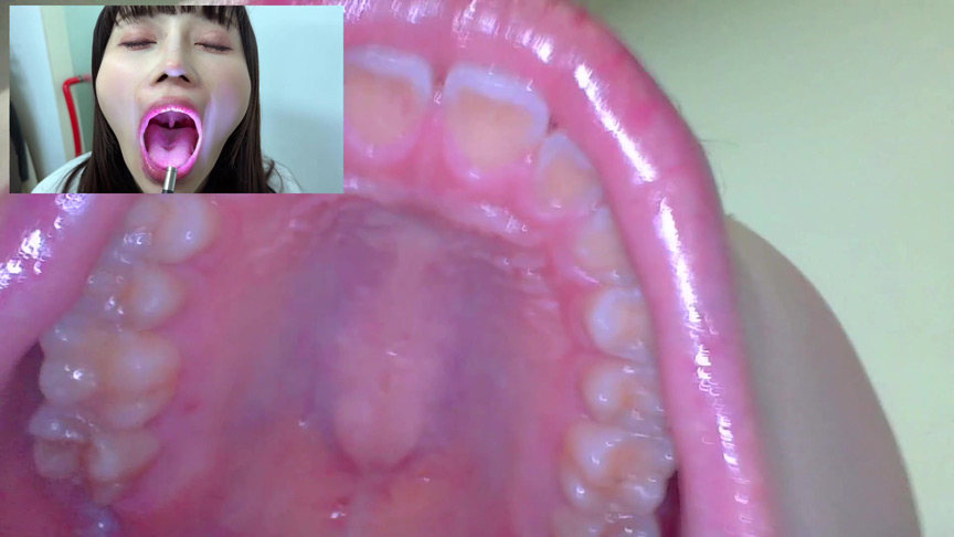 「【口腔観察】歯・舌・喉をじっくり接写!素人4名の口内フェチ動画55分セット」のサンプル画像4枚目