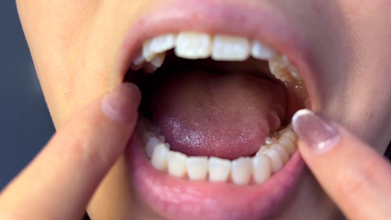 「【素人ナンパ】商社営業のお姉さんれなちゃんに街角で声かけ口内観察に挑戦」のサンプル画像4枚目