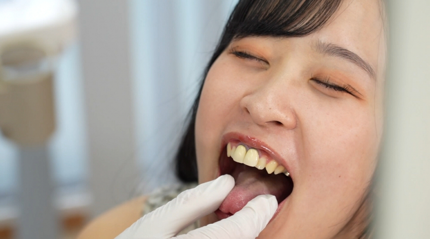 「朝比ゆの|保育士コスプレで口内観察フェチプレイ|舌・歯をじっくり見せる接写動画」のサムネイル