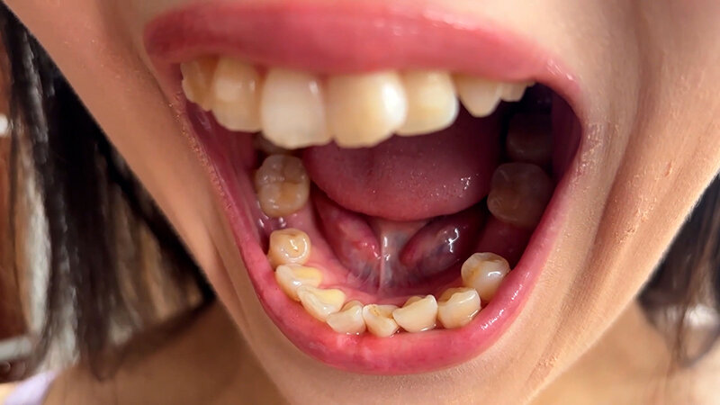 「【素人ナンパ】街角で声をかけたお姉さん店員みおりさんの恥じらい口内観察プレイ動画」のサンプル画像7枚目