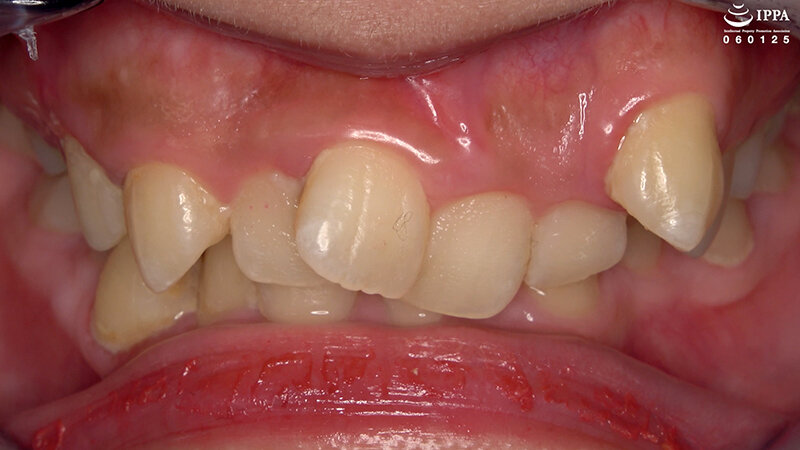 「【相楽さゆな】美少女M女の口内観察＆巨大女フェチプレイ｜歯・口腔フェチ動画」のサンプル画像3枚目