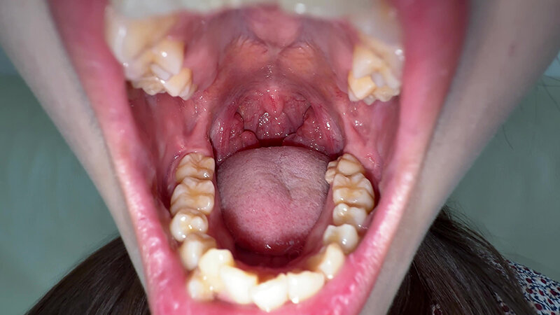 「【水月みお】素人お姉さんをナンパ！初めての喉奥体験と舌・八重歯観察の個人撮影動画」のサンプル画像4枚目