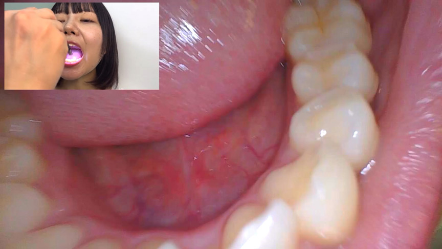 「【素人AD】みゆりちゃんの口内観察プレイ｜街角ナンパ企画で歯・舌・喉をじっくり撮影【フェチ動画】」のサンプル画像14枚目