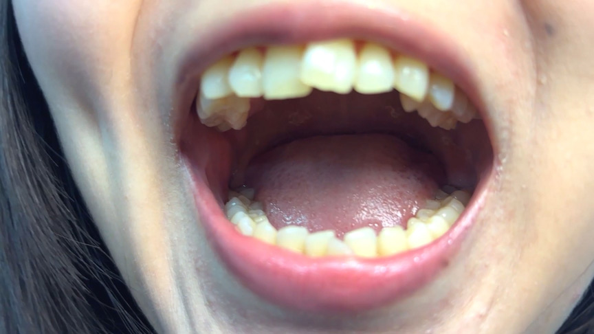 「【素人AD】みゆりちゃんの口内観察プレイ｜街角ナンパ企画で歯・舌・喉をじっくり撮影【フェチ動画】」のサンプル画像2枚目