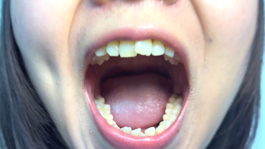 「【素人AD】みゆりちゃんの口内観察プレイ｜街角ナンパ企画で歯・舌・喉をじっくり撮影【フェチ動画】」のサンプル画像3枚目